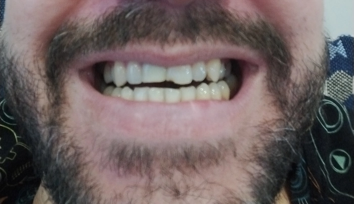 post-65413-1707283086323b_thumb.webp